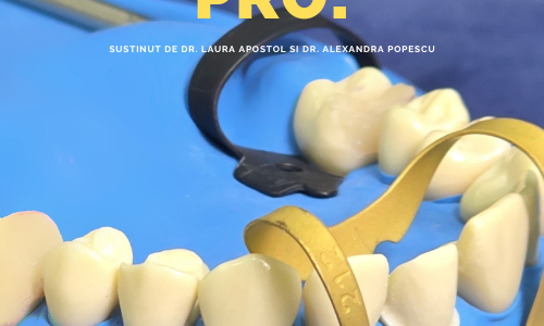 Dam it like a pro – Workshop de izolare cu Diga